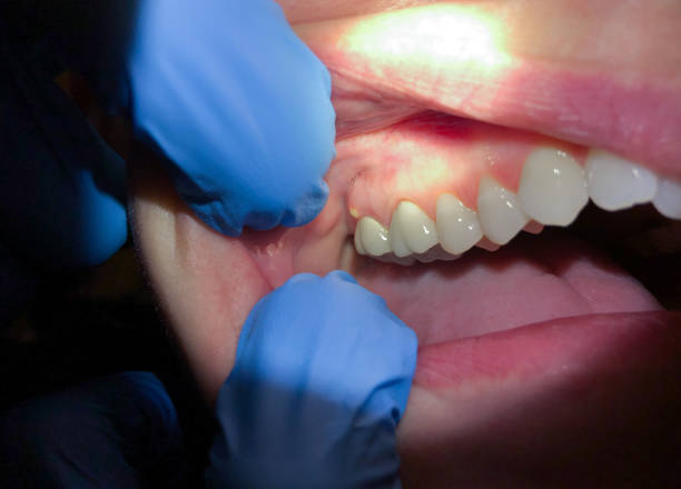 Best Broken Tooth Emergency  in Rush Springs, OK