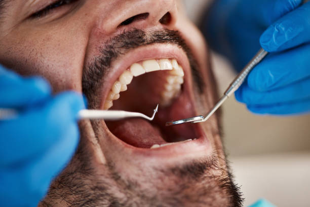 Best Dentist for Tooth Abscess  in Rush Springs, OK